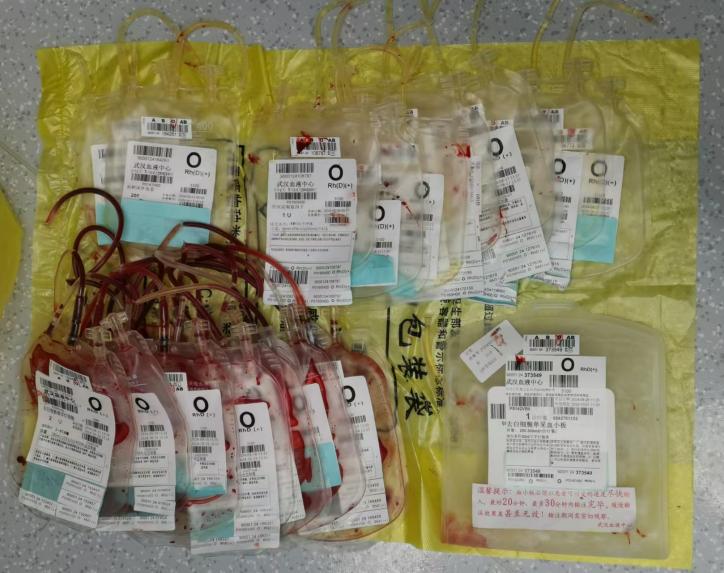 产后突发「致命洪水」 羊水栓塞！5 次全身大换血后，医护修改「生死簿」