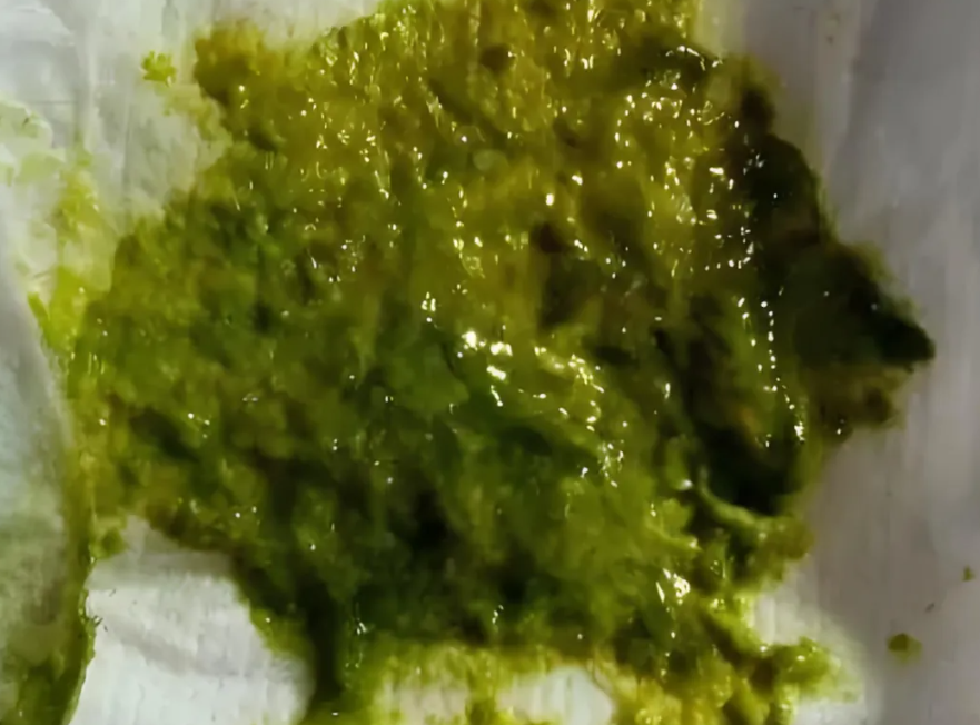 粪便里的秘密，教你便识宝宝的健康状态