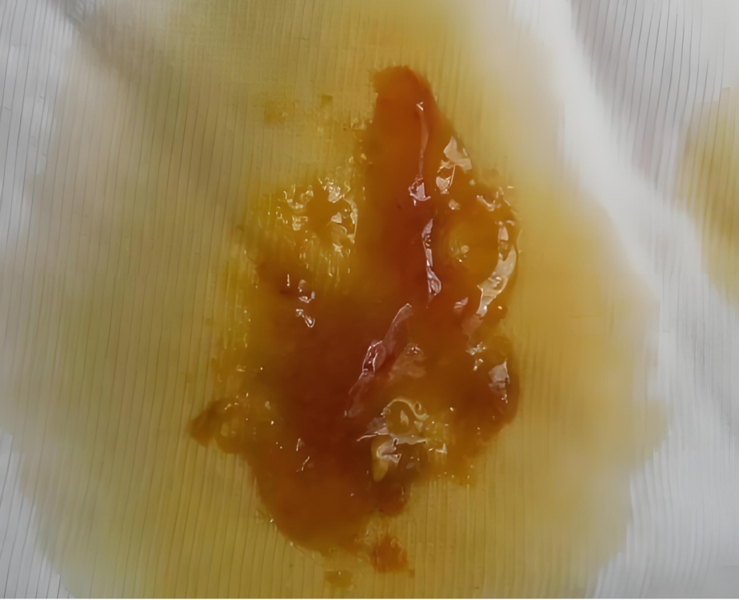 粪便里的秘密，教你便识宝宝的健康状态