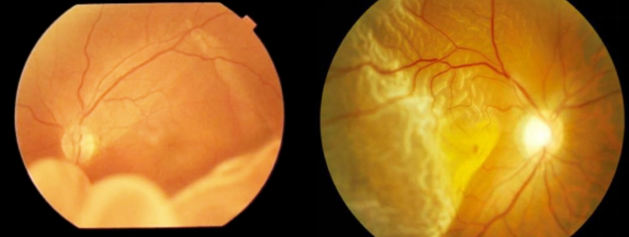 定期眼检,筑好「视」界安全网