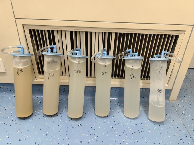 3 小时 11 分钟挑战极限！成都京东方医院成功为高危患者「清洗」肺脏