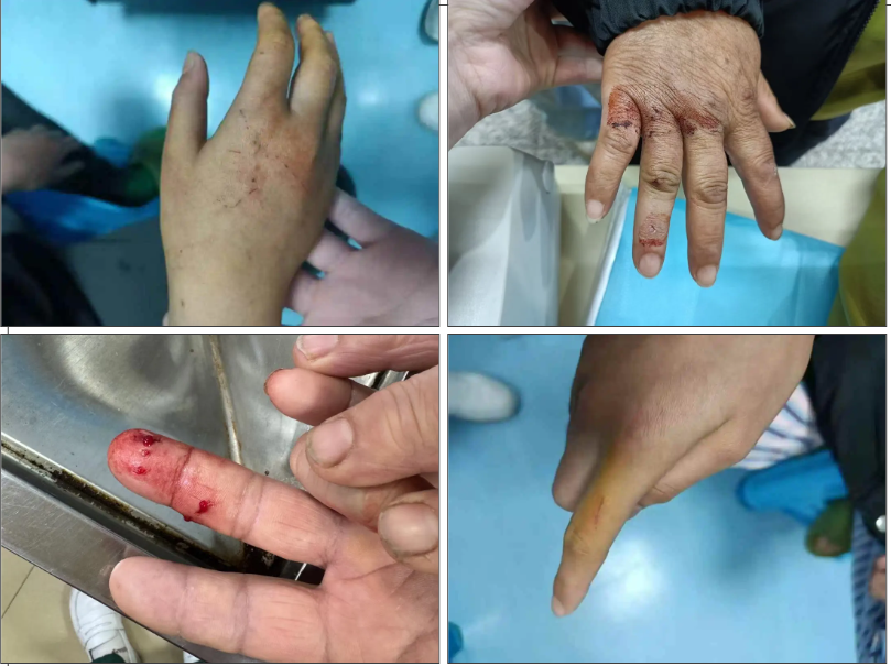 致死率极高！春节期间这种伤害多发