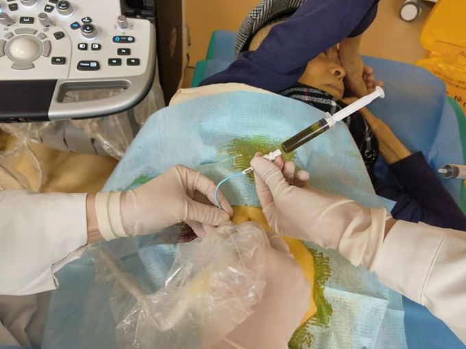 超声 「针」 功夫：毫米间的生命守护！