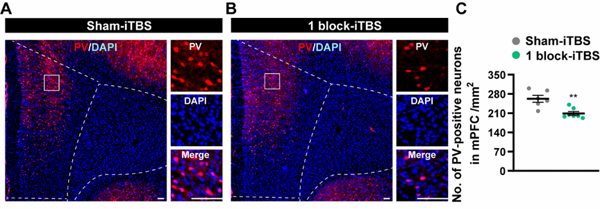 西安交大二附院康复医学科神经康复团队 2025 年初 2 篇高质量论文在线发表