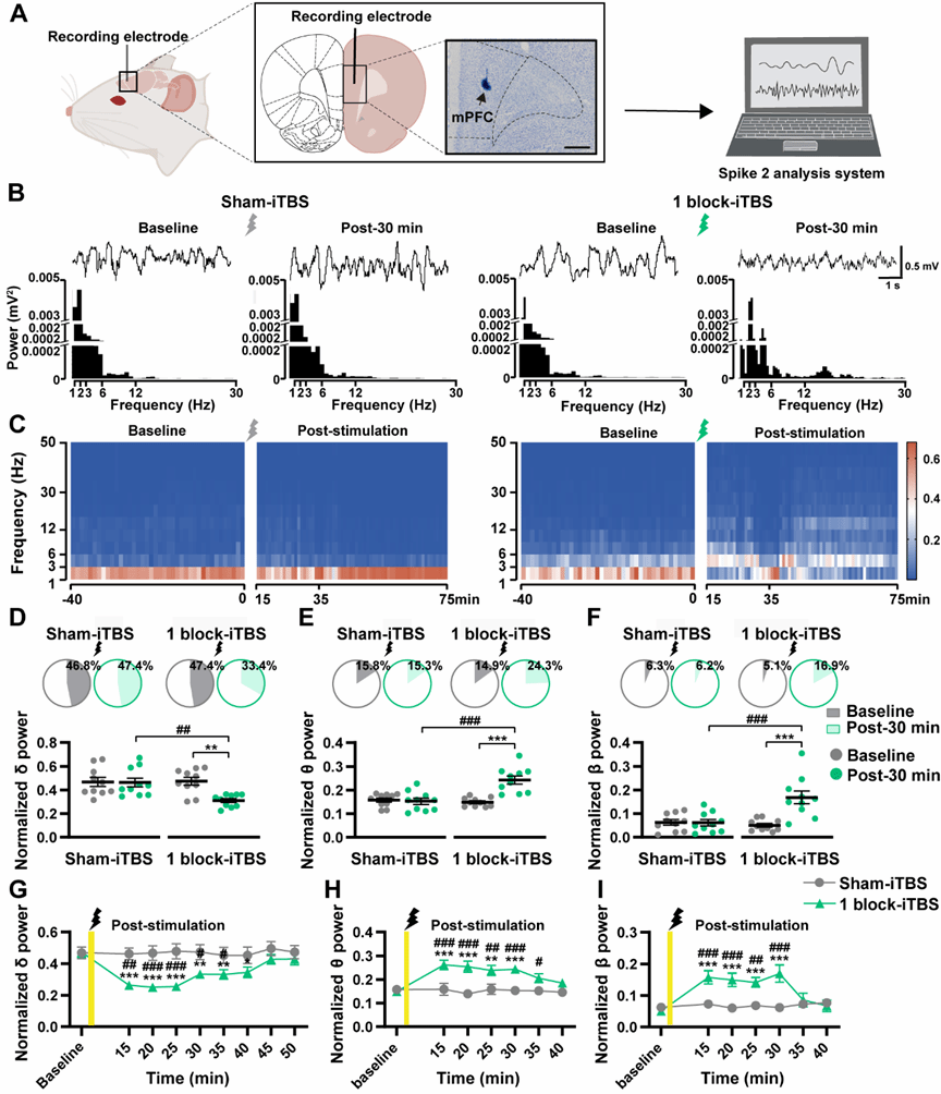 西安交大二附院康复医学科神经康复团队 2025 年初 2 篇高质量论文在线发表
