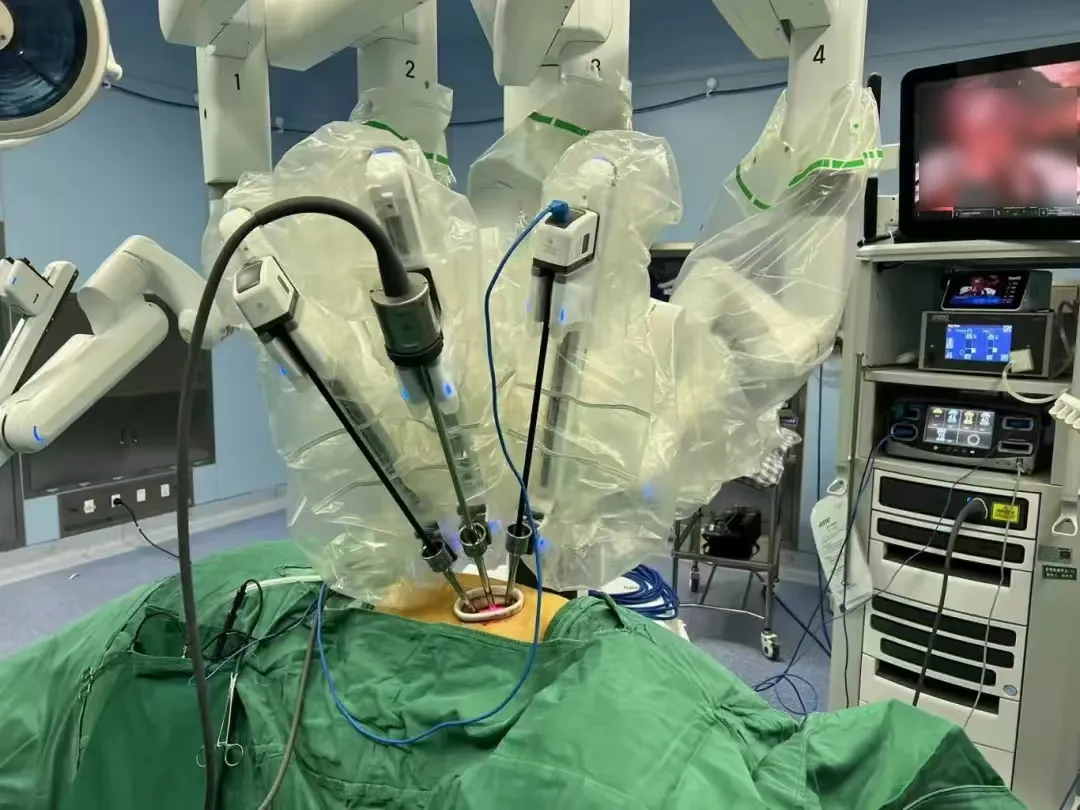 精准完成手术 500 例！ 荆门市中心医院这台机器人厉害了...