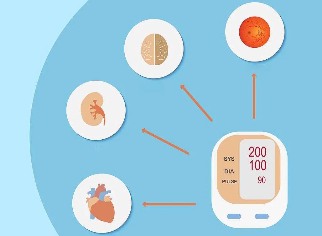 合肥京东方医院科普：「高血压」需要综合管理