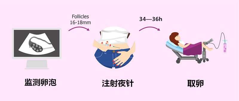 夜针小课堂:第 4 条别忘了叫上老公一起看!