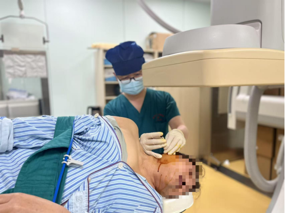 频繁不自觉闭眼原是患上「梅杰综合征」 微创射频治疗助教师重获清晰视界