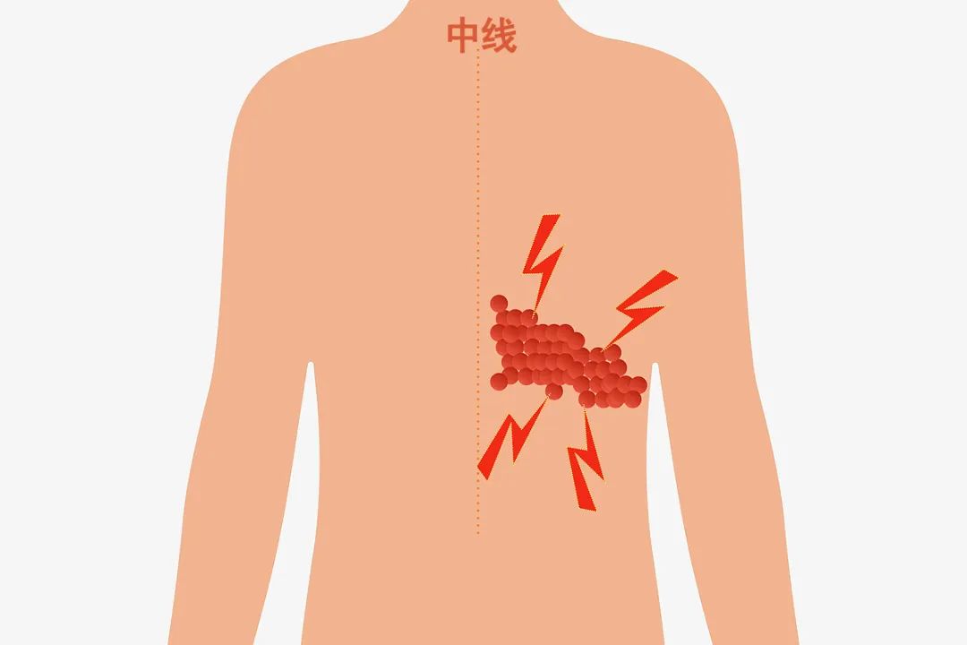 合肥京东方医院科普：带状疱疹-水痘病毒一旦感染，终身携带！1 个方法提前预防