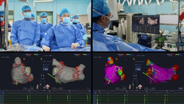 国产惠泰压力指示脉冲电场消融房颤西北地区首例应用成功