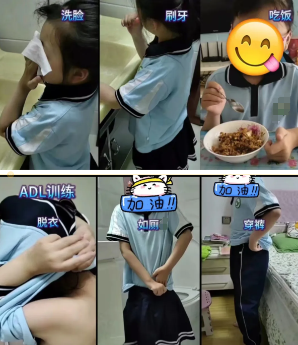 【国际罕见病日】还好，这个罕见的女孩有不凡的爱护