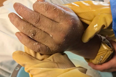 身心并护！ICU 护理专家变身「Tony 老师」、「搓澡大叔」