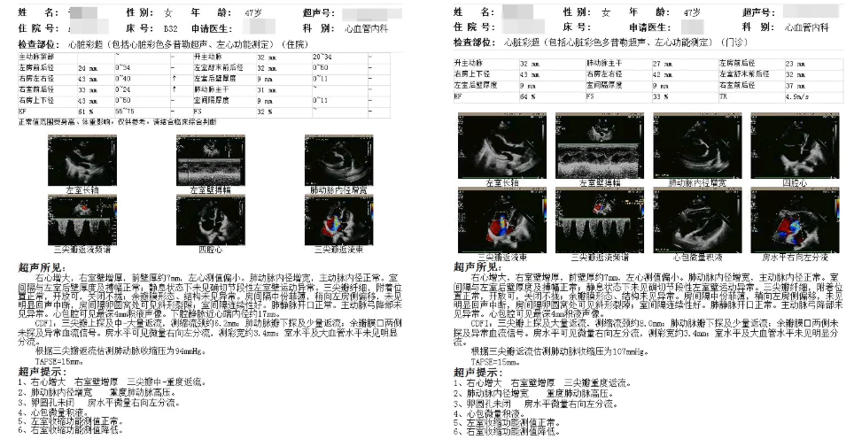 绵阳市中心医院率先完成全国首批 PADN 技术临床应用