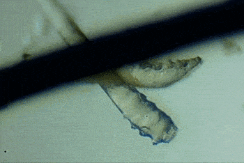 引起眼干眼痒的原因有哪些?武汉普瑞眼科徐静提醒小心螨虫作怪