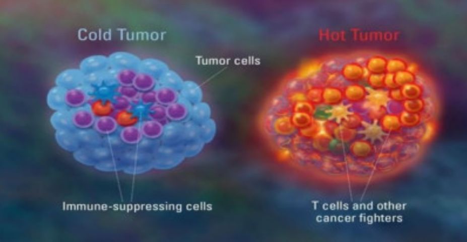 用高温能「杀死」癌细胞?这不是谣言,是真的!