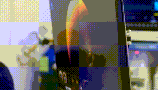 夺命「猫眼」:著名作家女儿 18 个月去世,早期无明显症状