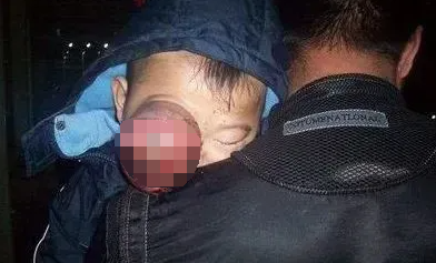 夺命「猫眼」:著名作家女儿 18 个月去世,早期无明显症状