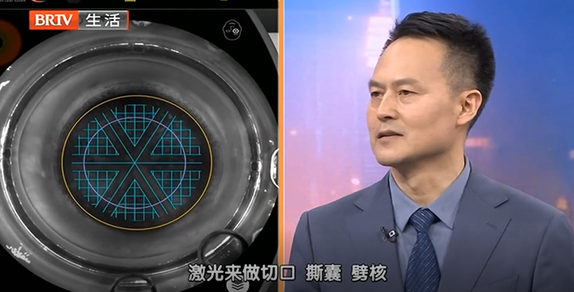 北京华厦民众眼科医院:飞秒「无刀」除「障」,让视力更清晰
