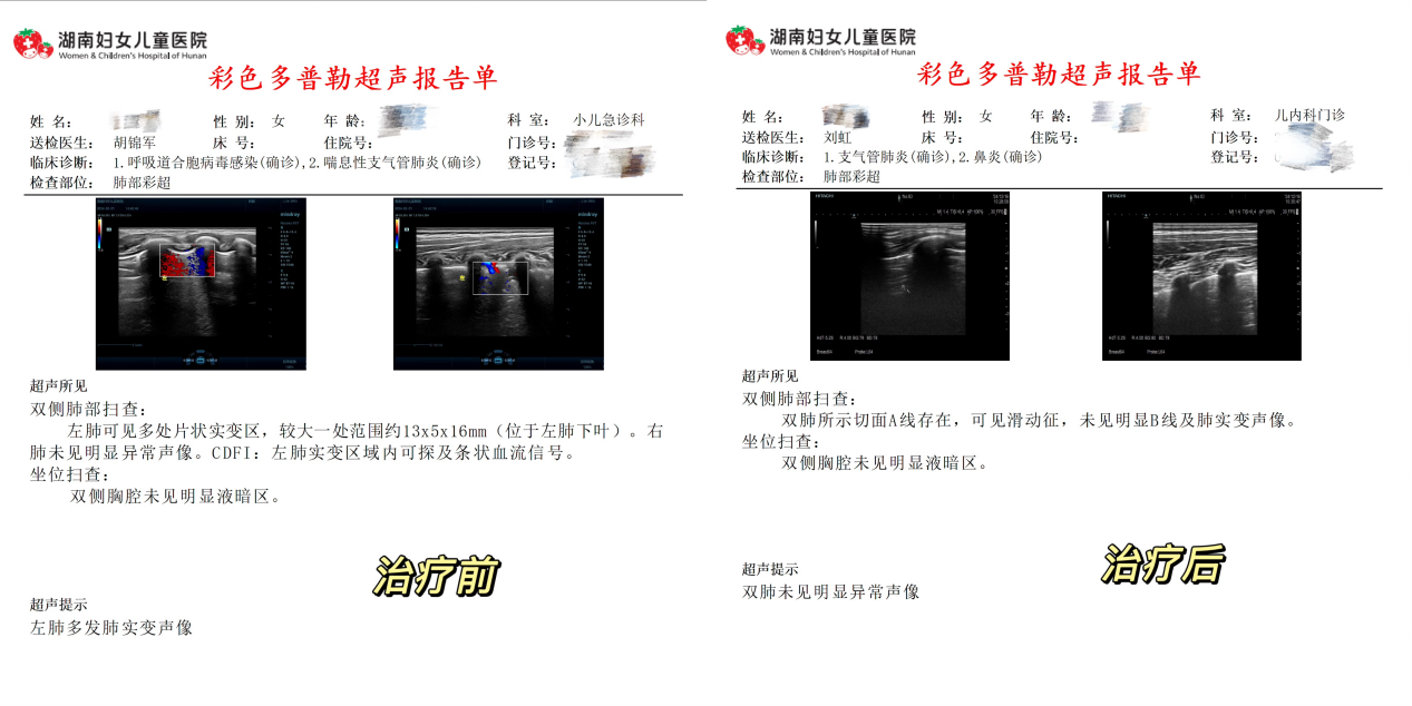 反复咳嗽、流涕 4 个月，以为是感冒，一查竟是过敏引发的「咳变异性哮喘」！