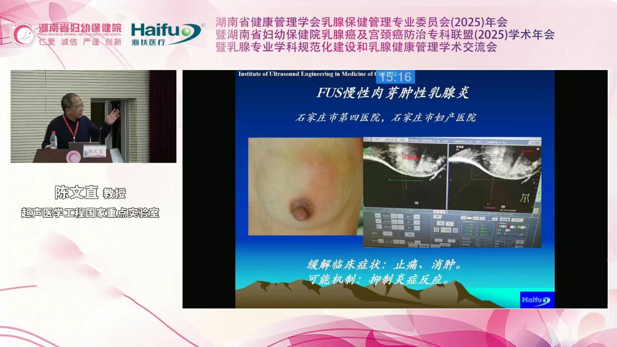 重庆海扶医院陈文直教授：聚焦超声消融在女性中临床应用的进展