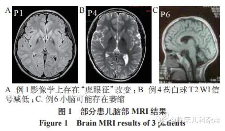 脑组织铁沉积神经变性病患儿的临床与遗传学分析