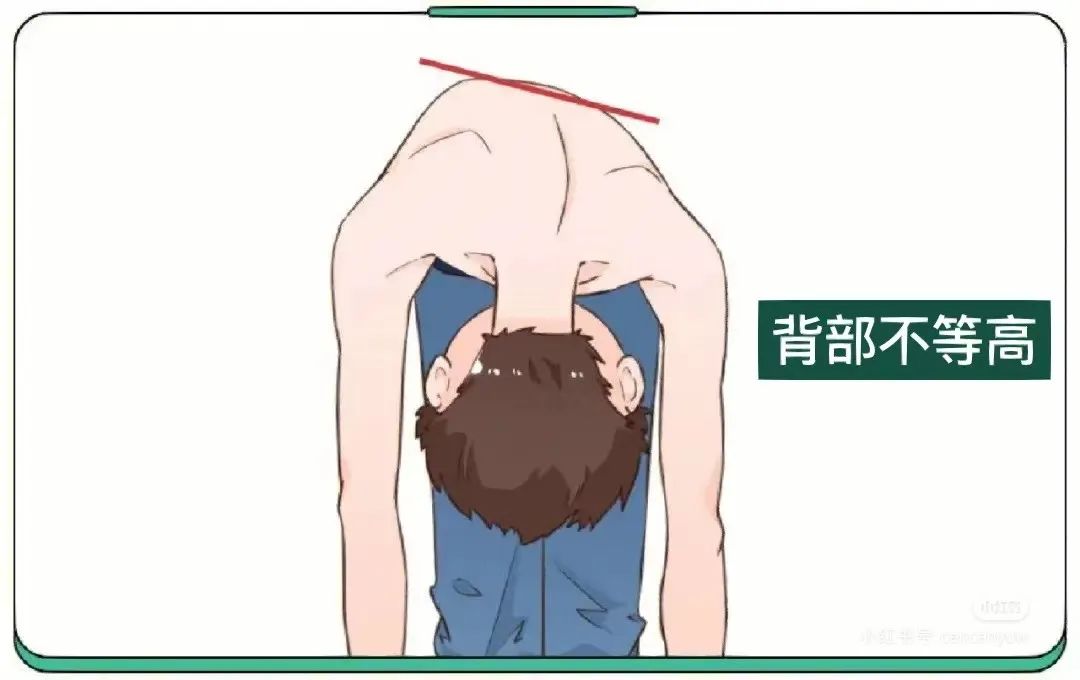 你的脊柱悄悄弯成「贪吃蛇」?速测气质杀手「S 弯超标没」!