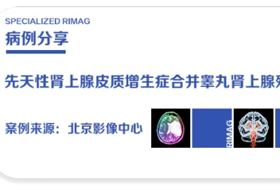 守护青春的希望：一脉阳光影像中心精准诊断助力少年战胜罕见疾病