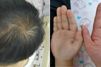 病例会说话 | 儿科精准诊疗：揭开甲减背后的多系统健康谜题