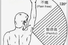【健康科普】肩痛就是肩周炎？还需警惕「肩袖损伤」！