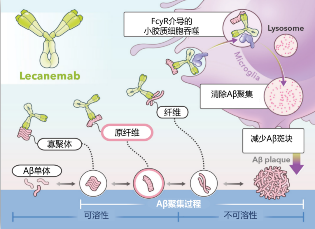 早期老年痴呆也能逆转！？义乌阿姨用上特效药，清除大脑「有害蛋白」