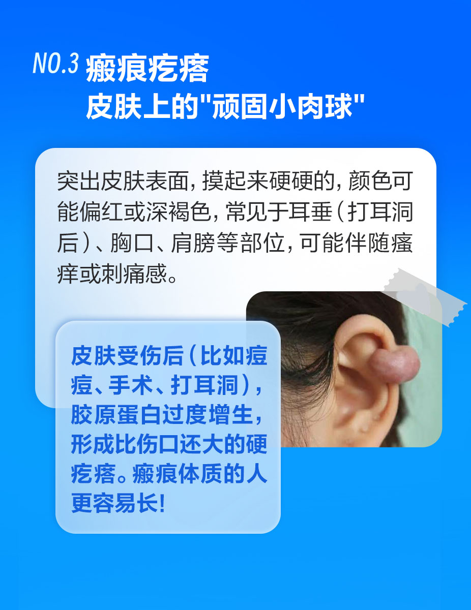 这些皮肤包千万别挤！当心越弄越糟