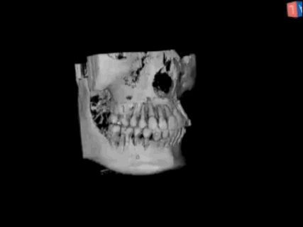 埋伏 20 年，她用 5 年时间让 3 颗大门牙「重见天日」