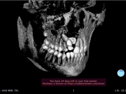 埋伏 20 年，她用 5 年时间让 3 颗大门牙「重见天日」