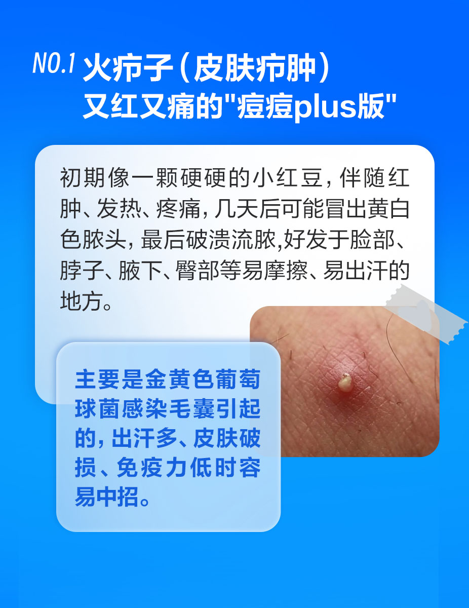 这些皮肤包千万别挤！当心越弄越糟