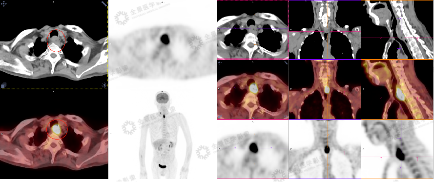 镜影联合|是什么原因让诊疗经验超 5 万例的主任医师中断检查？