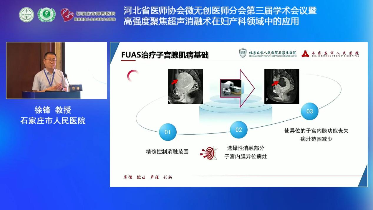 石家庄市人民医院徐锋：聚焦超声消融手术在子宫腺肌病生育力保护中的应用