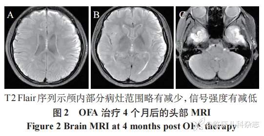 1 例青少年难治性视神经脊髓炎谱系疾病的诊治