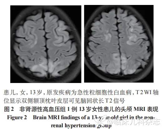 不同病因儿童高血压脑病临床特征比较：一项单中心 12 年回顾性分析