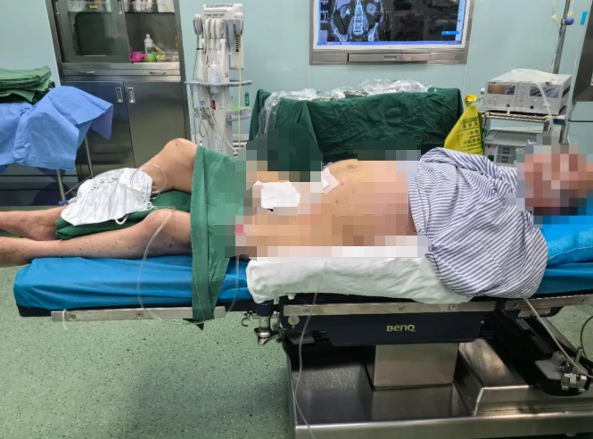 当截石位「失效」，漳州三院如何完成这场泌尿系结石手术