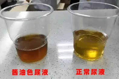 吃小龙虾：美味与风险并存，安全处理不可忽视！这篇科普让你看懂潜在风险！