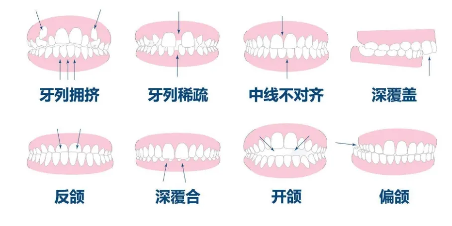牙齿深夜开磨盘，这是在偷偷搞装修？