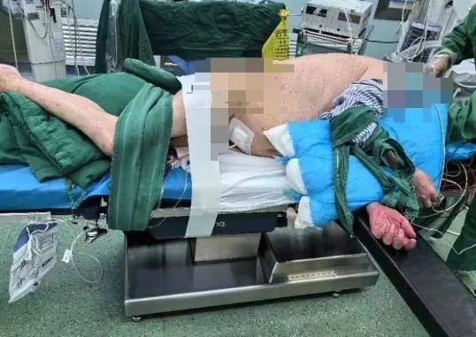 当截石位「失效」，漳州三院如何完成这场泌尿系结石手术