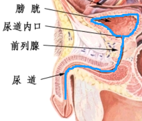 尿血 3 个月，医生从他膀胱取出 72 颗「彩虹糖」？！