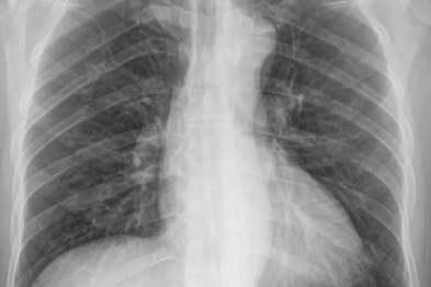 去医院拍片像点菜？X 光、CT、核磁共振到底该「点」哪个？