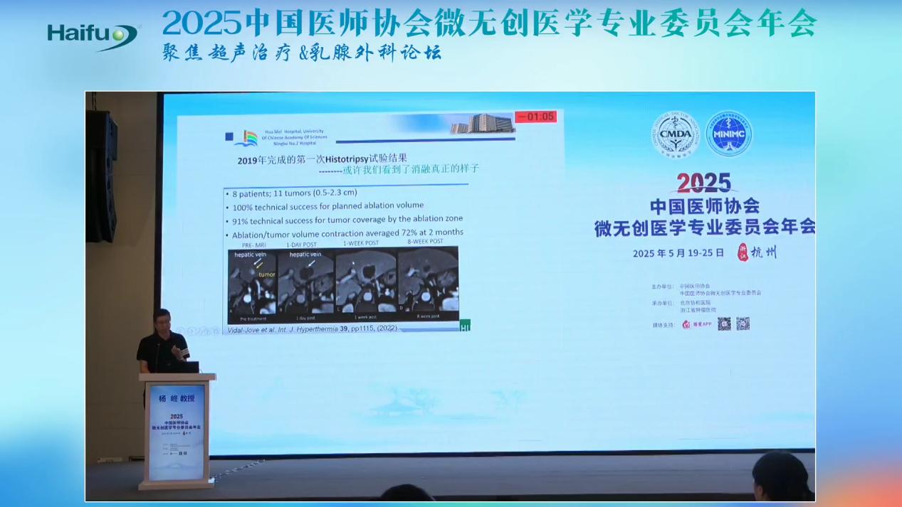 宁波市第二医院杨峂教授：高强度聚焦超声消融技术正在成为肿瘤消融的核心技术之一