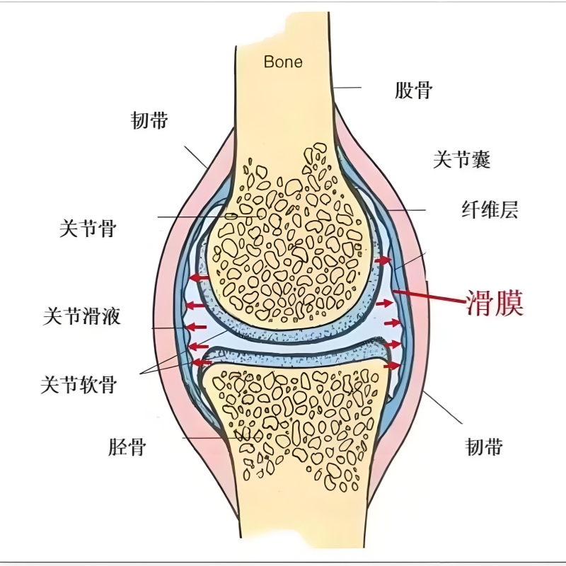 【高尚病例】少见而又经典的影像-滑膜树枝状脂肪瘤