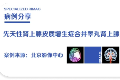 隐藏在青春里的「不速之客」——超声火眼金睛，守护男孩未来