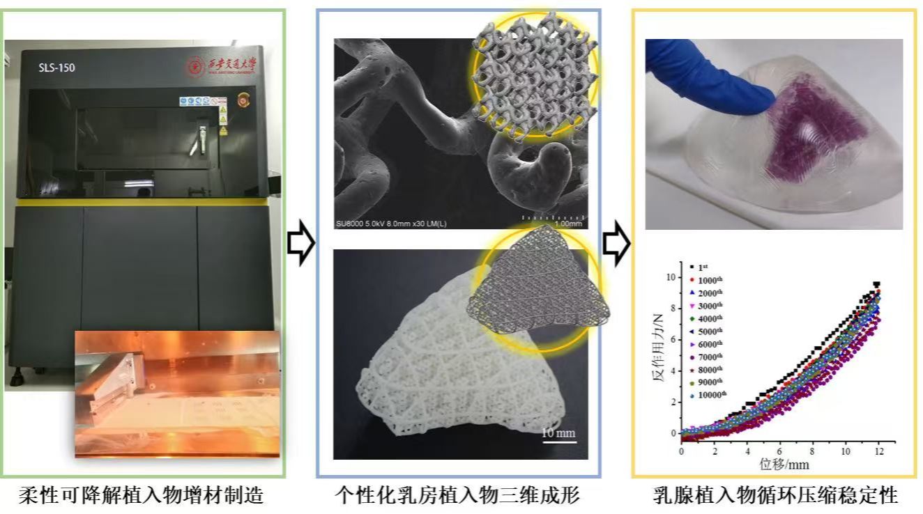 国内首项个体化 3D 打印可吸收支架联合脂肪移植部分乳房重建临床研究在交大二附院启动