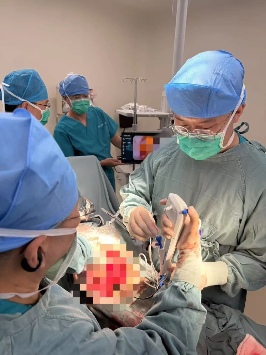 高龄老人饱受肝胆内外结石折磨十余年，多学科联手成功破解顽疾